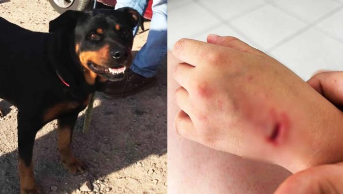 Niña sufre ataque de perros en colonia Cumbres