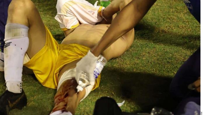 Jugador brasileño resulta herido por disparo de policía 