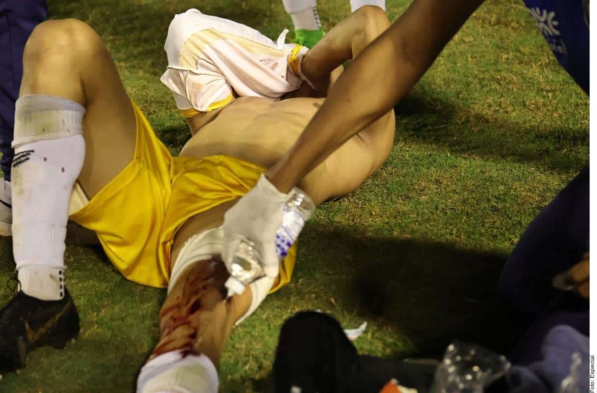 Jugador brasileño resulta herido por disparo de policía 