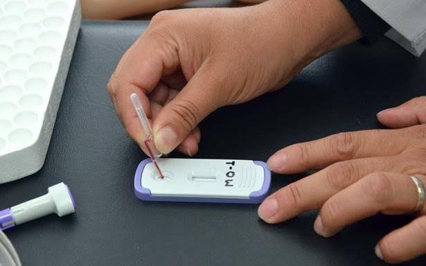 Ya van 18 casos de VIH este año en Acuña