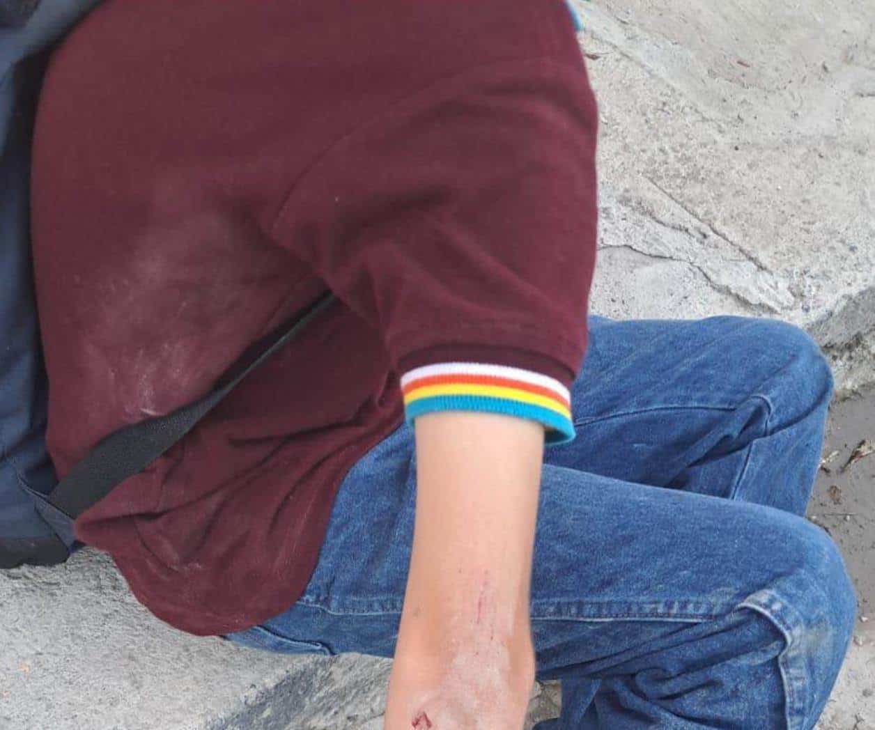 Denunciarán a joven que embistió a menor de edad