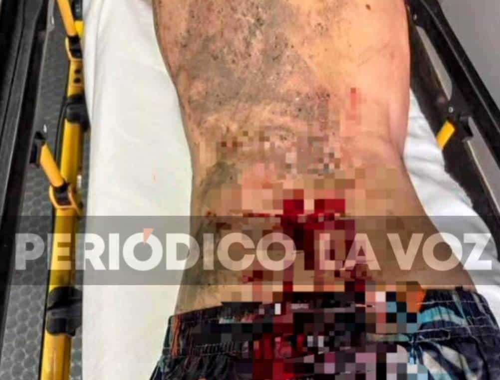 Hombre es Herido por su Esposa con Navaja