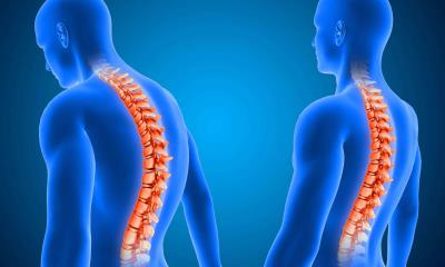 IMSS: Recomienda traumatólogo tomar acciones preventivas para cuidado de columna vertebral