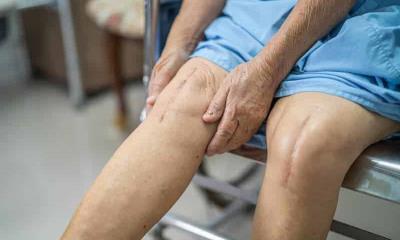 Tendrá hospital general jornada de cirugías de prótesis de rodilla