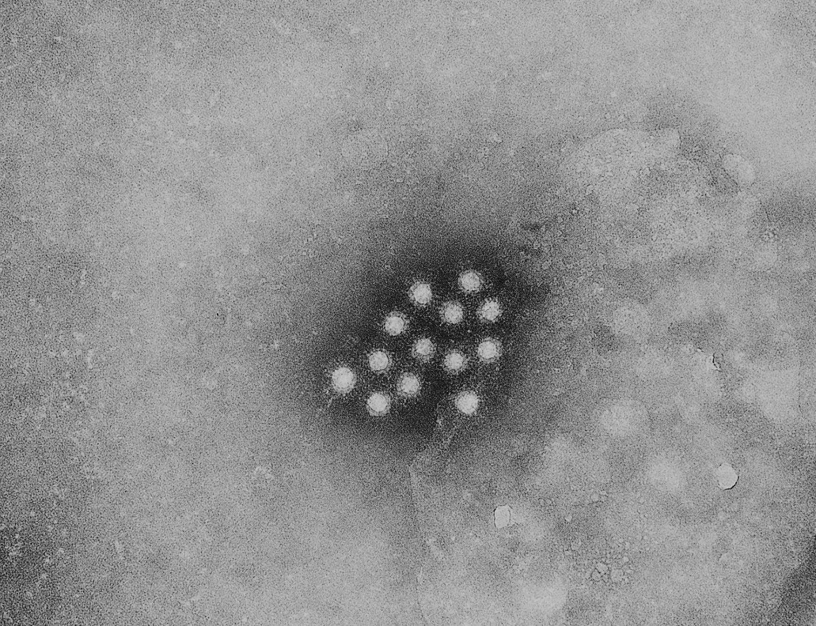 Alerta por Aumento de Hepatitis A en Piedras Negras; sí tiene CURA