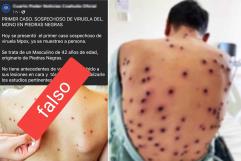 LO DESMIENTEN: Circula en redes información FALSA sobre VIRUELA DEL MONO en Piedras Negras