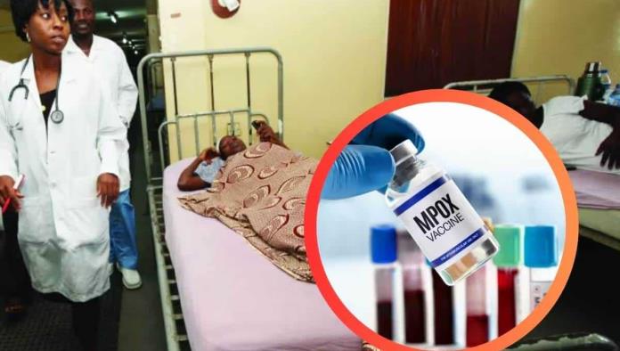 Nigeria ya tiene vacuna contra la viruela del mono (Mpox)