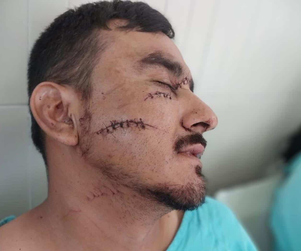 Agresión en celebración de ejido Palo Blanco deja a castañense en estado grave