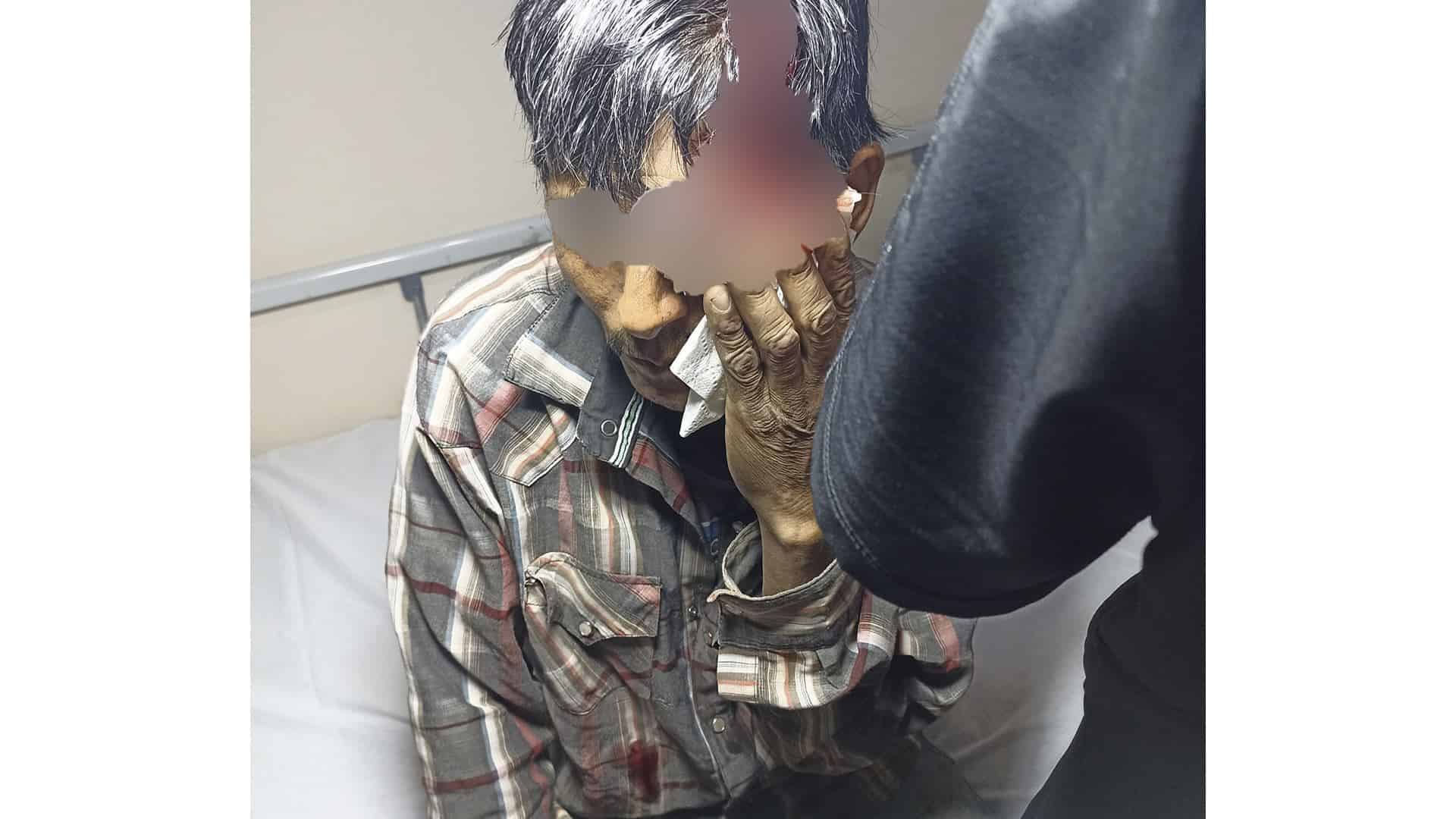 El adulto recibió atención médica luego de las pedradas de los elementos.