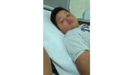 Niño de 6 años en terapia intensiva por dengue