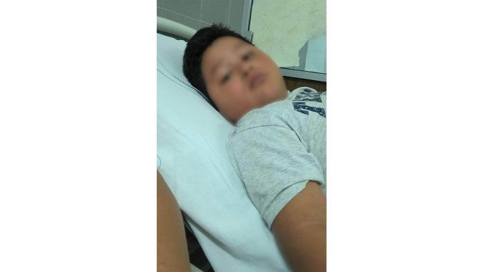 Niño de 6 años en terapia intensiva por dengue