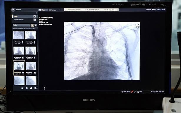 IMSS Coahuila Llama a la Prevención de Enfermedades Cardiovasculares