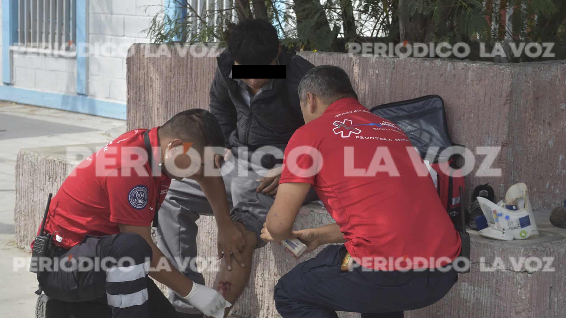 Perro tumba de moto a estudiante del COBAC