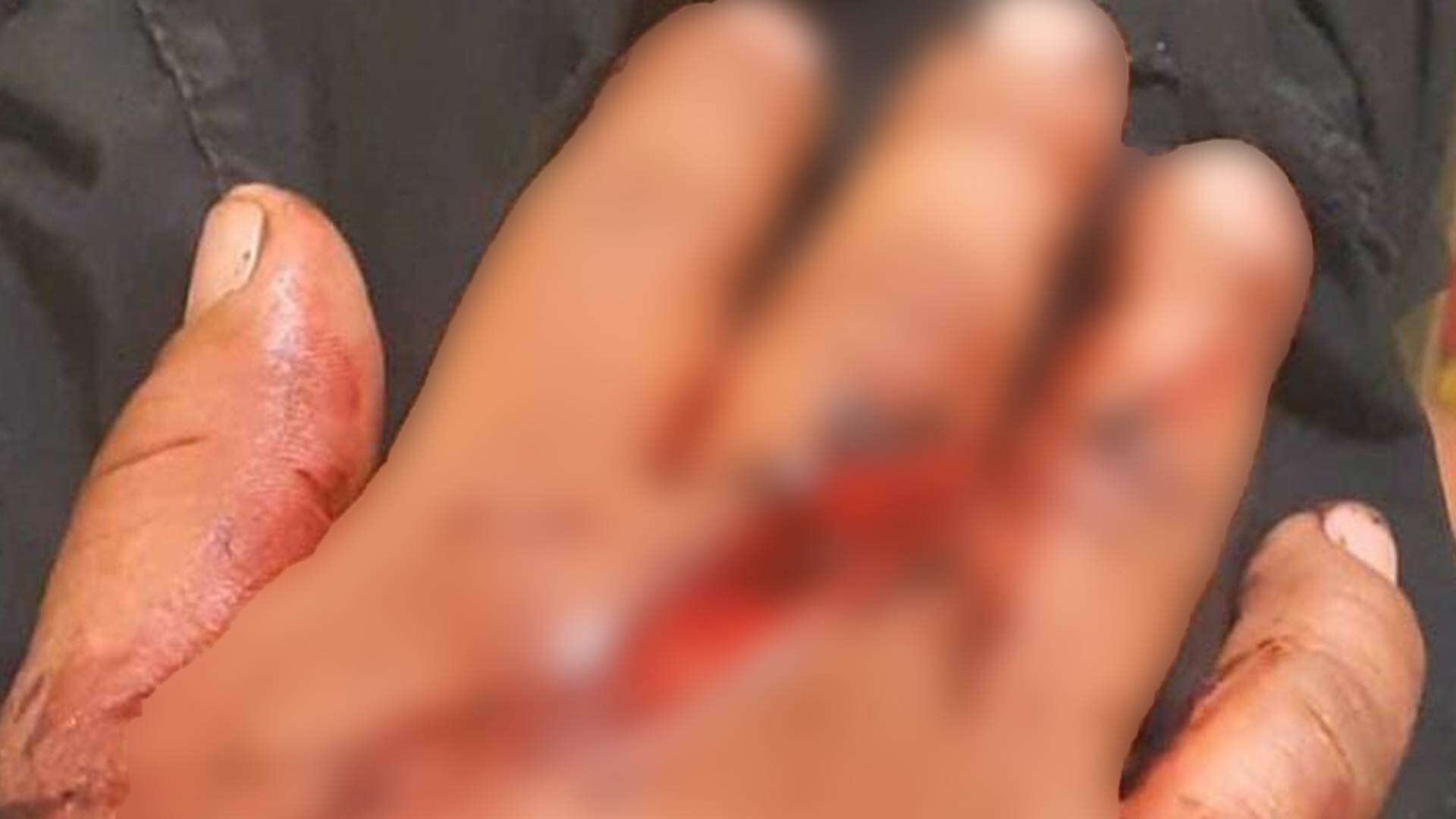Con heridas en diferentes partes del cuerpo terminó la víctima.