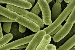 Ya van 75 infectados con E.coli en Estados Unidos