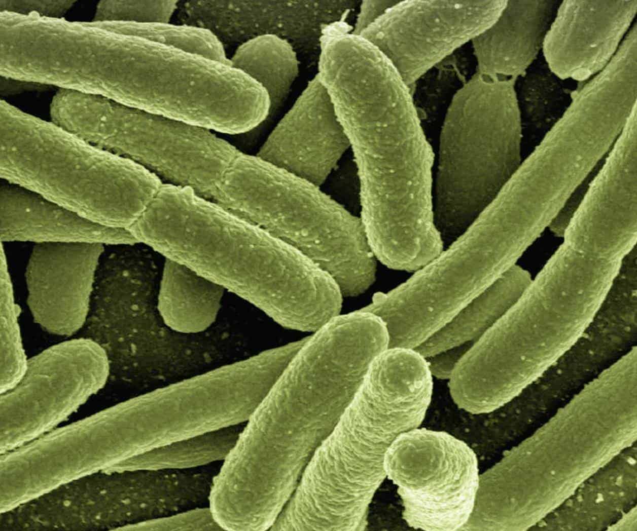 Ya van 75 infectados con E.coli en Estados Unidos