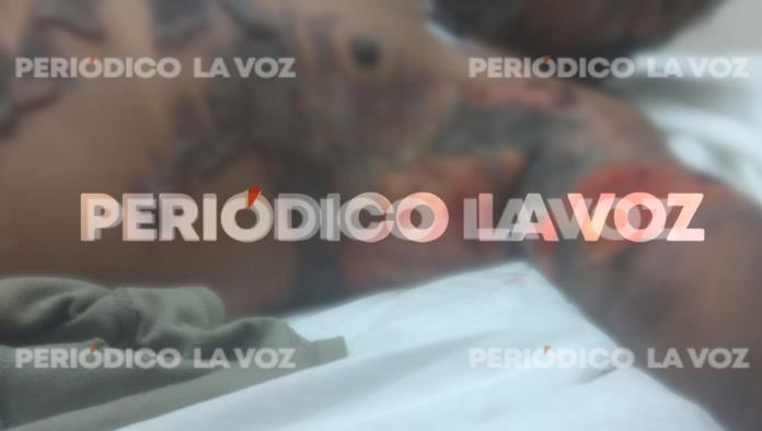 Por culpa de sus vicios, por poco muere quemado