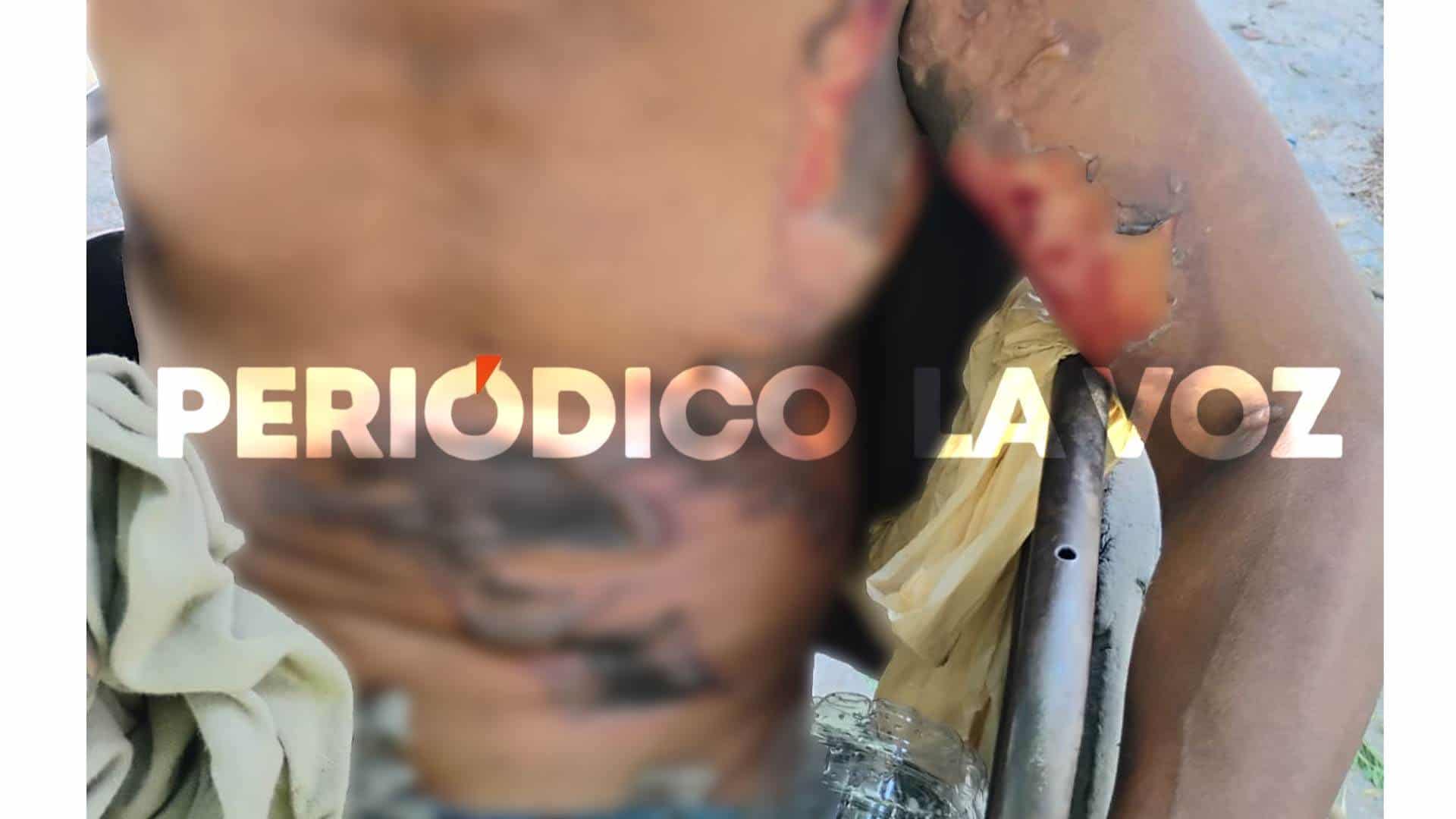 Por culpa de sus vicios, por poco muere quemado
