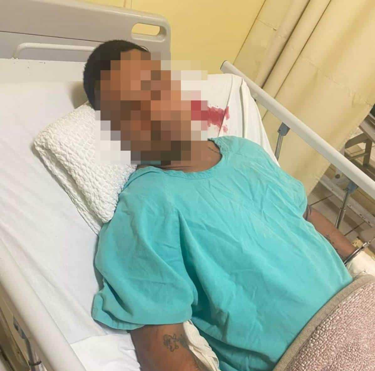 El tripulante de la motocicleta sobrevivió al accidente tras una persecución.