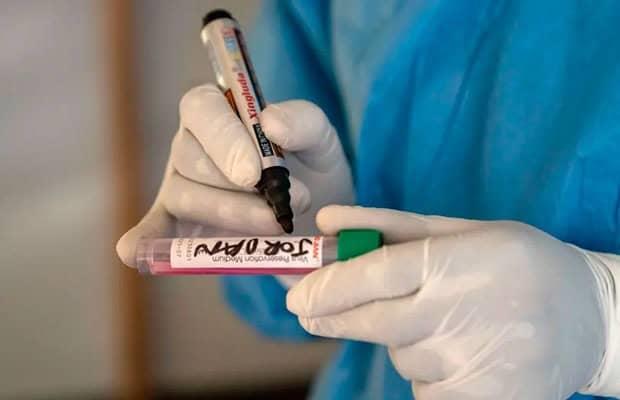 Francia confirmó su primer caso de la nueva variante clado 1b del virus mpox