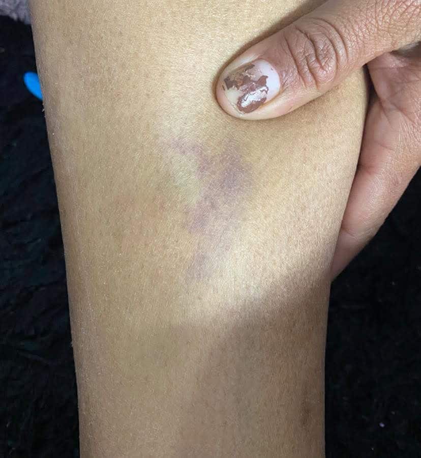 Denuncian maltrato en anexo.