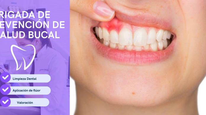 Inicia brigada de salud bucal en Piedras Negras para prevenir complicaciones dentales Inicia brigada de salud bucal en Piedras Negras para prevenir complicaciones dentales