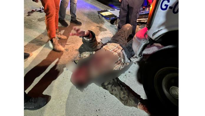 Pierde ´El Indio´ pelea por botellazo en la cara