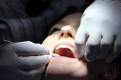 Influencia de la estética dental en el mundo moderno