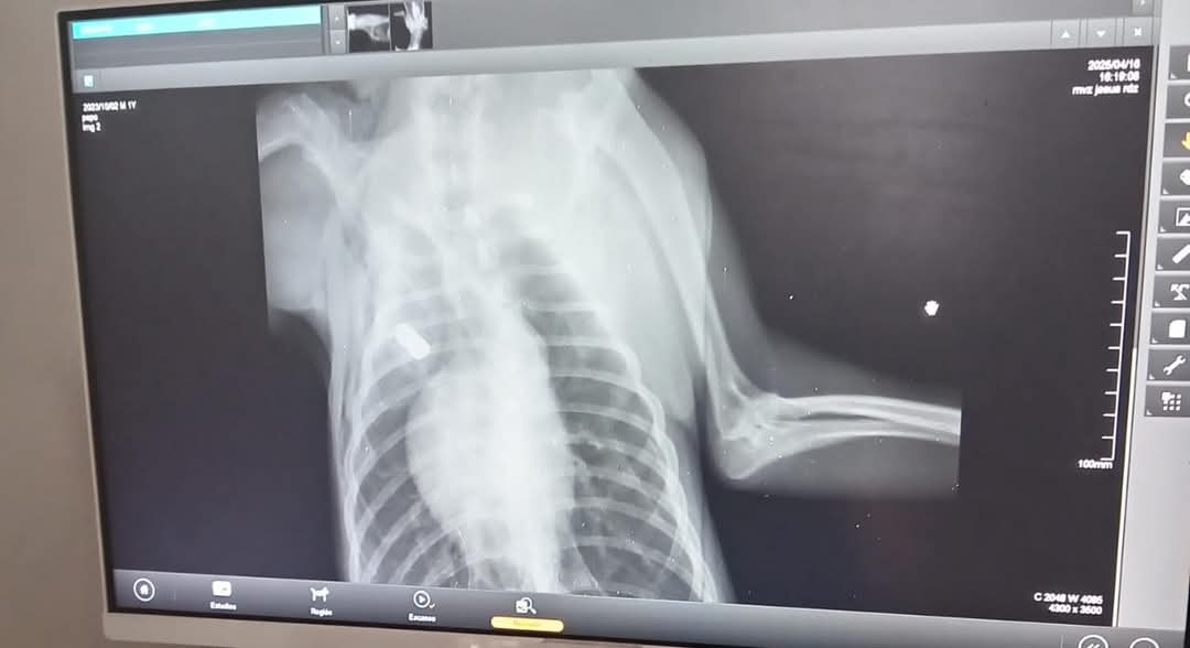 Los estudios médicos revelaron la herida de bala, que se situaba como una calibre 22.