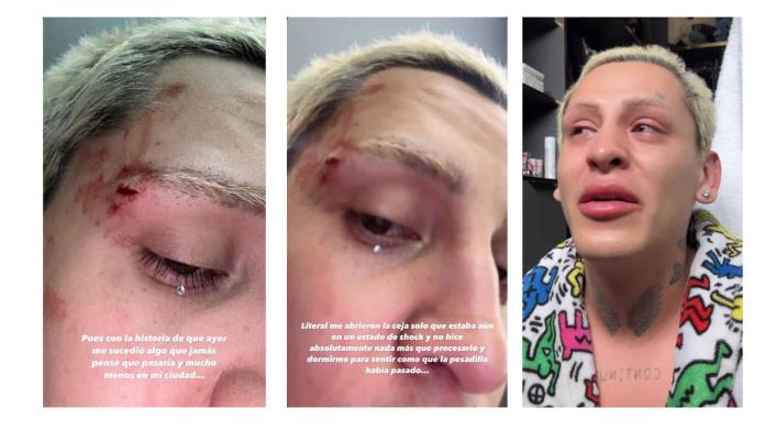 GOLPEAN A KUNNO: Sufre agresión homofóbica en Monterrey GOLPEAN A KUNNO: Sufre agresión homofóbica en Monterrey
