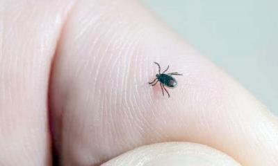 Muere niño de Rickettsia