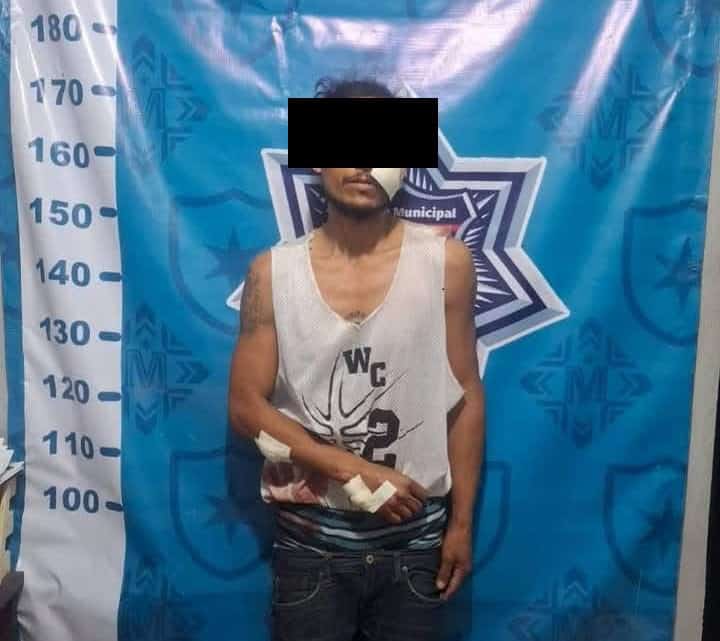 Machetea a su ex y le roba celular