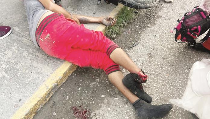 Se amputa pie en fuerte accidente Se amputa pie en fuerte accidente