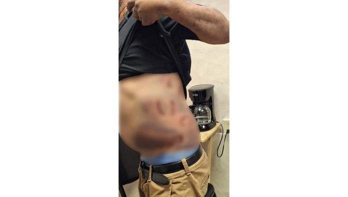 Brutal agresión a indigente en Monclova: adulto mayor sufre graves lesiones físicas