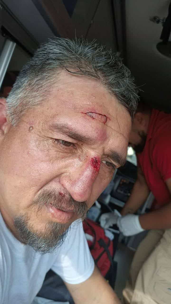 Termina volcado en la carretera 57 por tomar café al volante