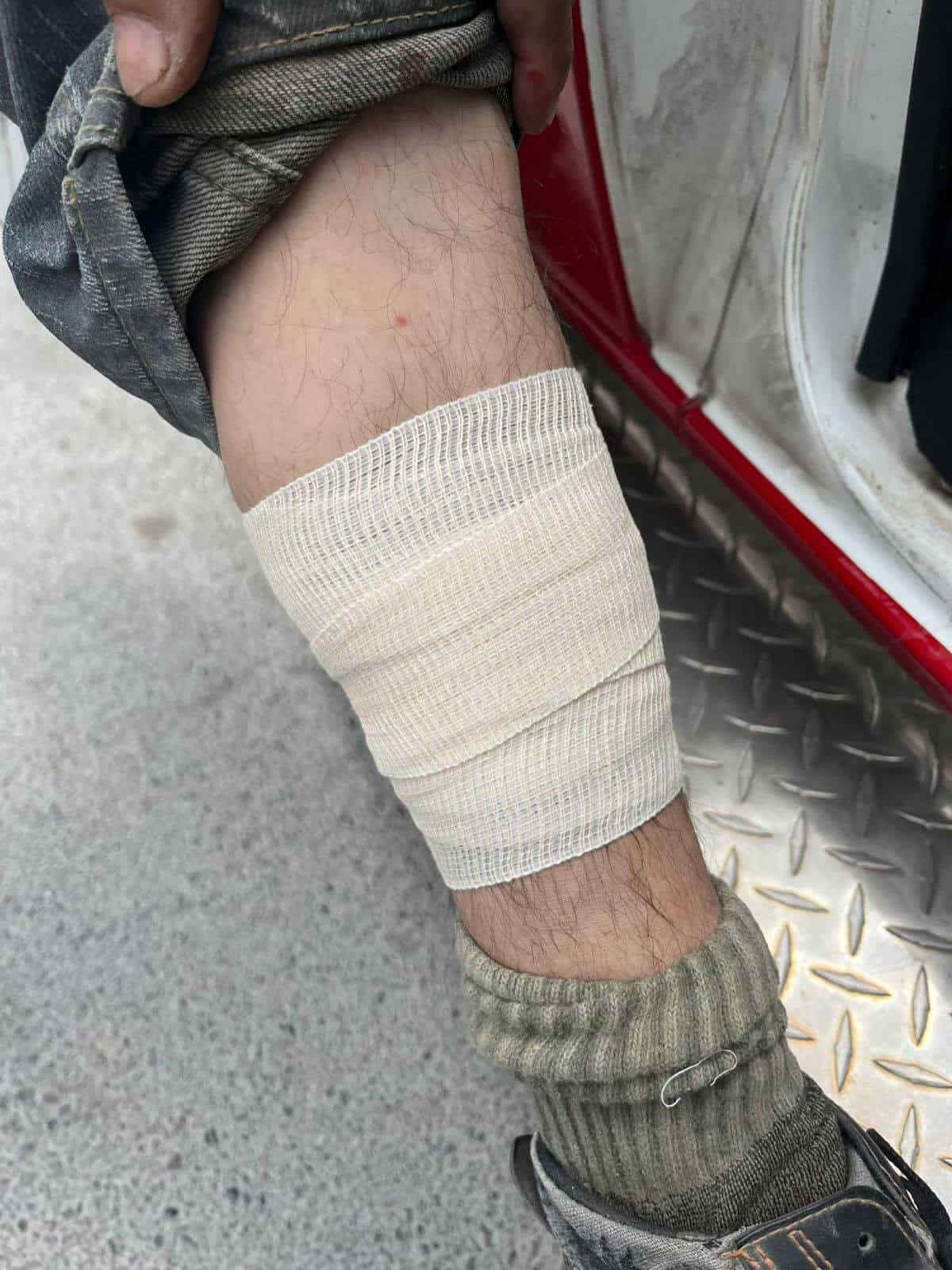 Atienden a dos lesionados tras choque en Allende