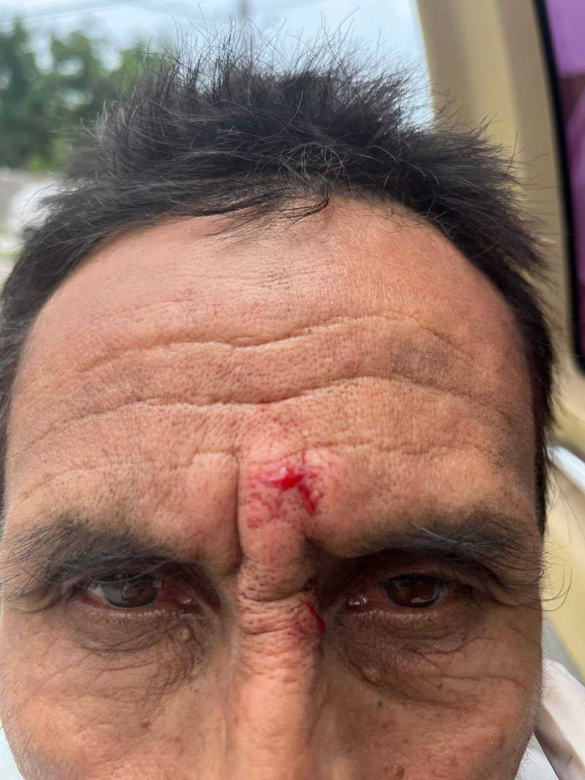 Atienden a dos lesionados tras choque en Allende