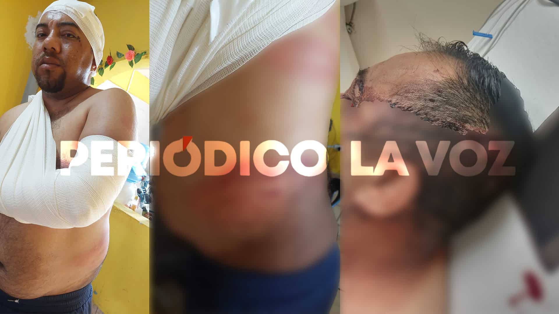 "Atropelló a Wendy Lizbeth, pero no está solo": padres de Maurilio rompen el silencio