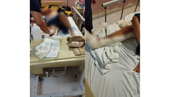 Cristian fue atropellado y arrastrado 15 metros; su madre clama por justicia