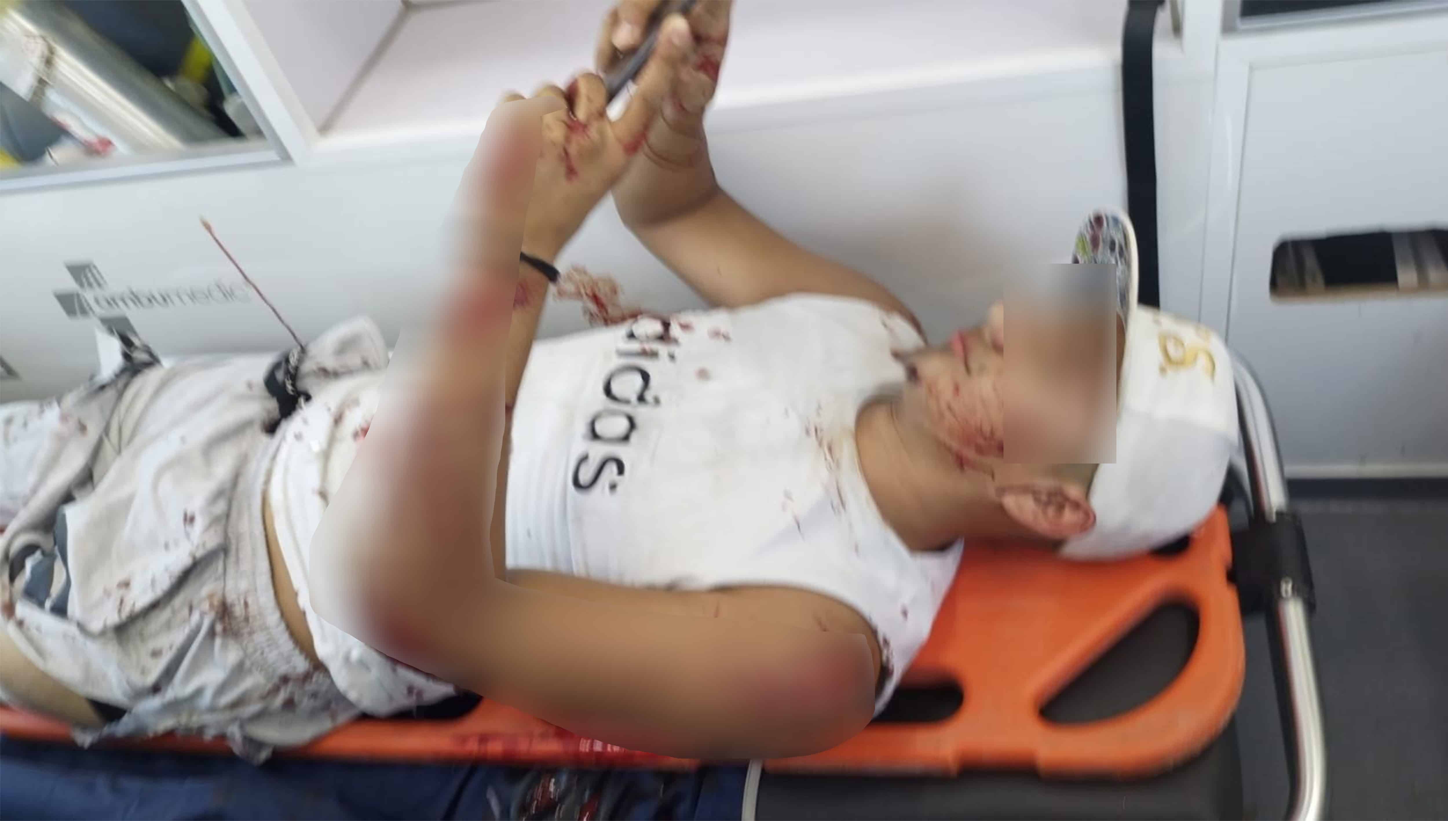 Joven motociclista sufre grave accidente en un cruce peligroso de Villa Unión