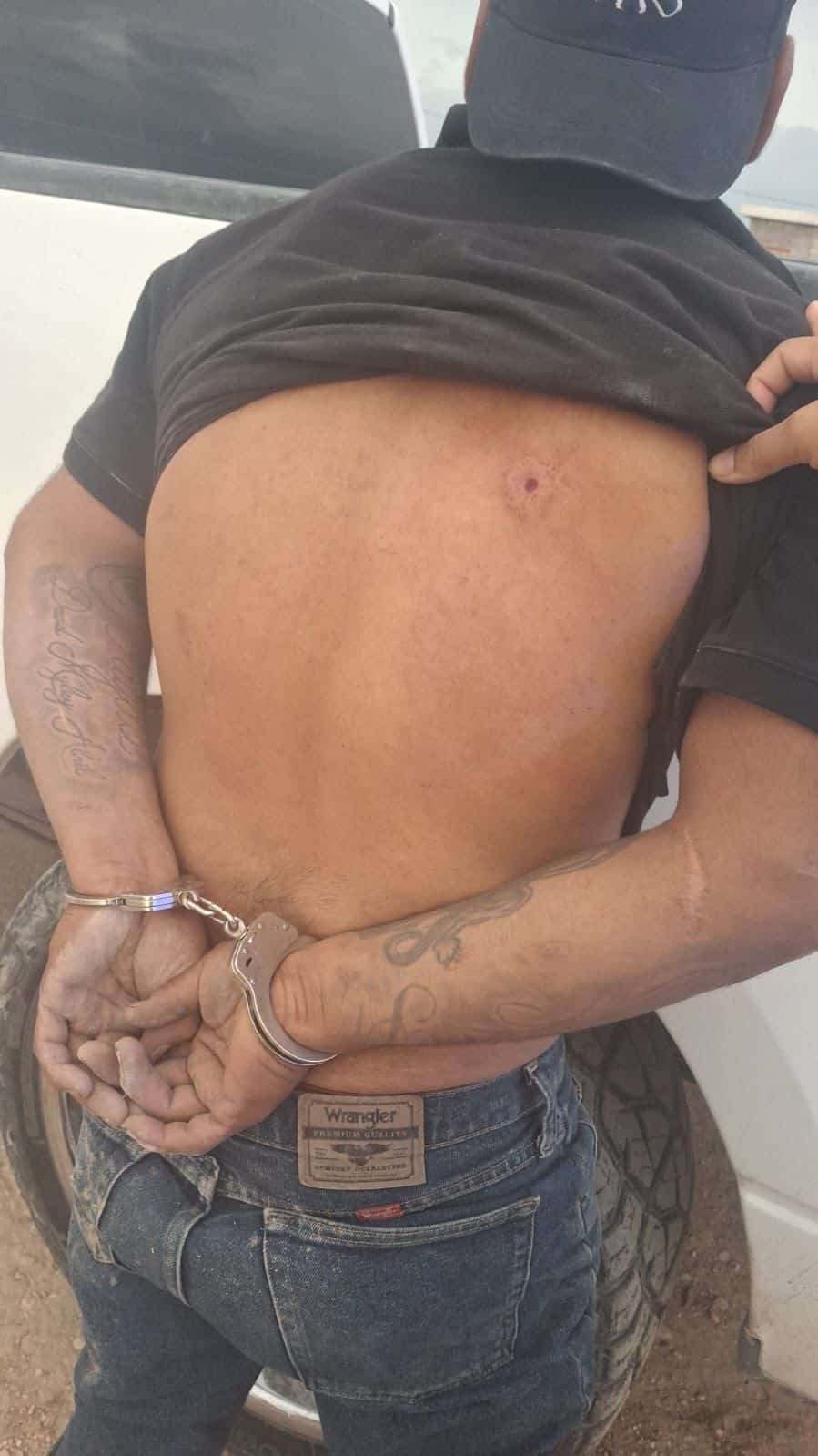 Intento de robo termina con un disparo en la espalda enAcuña