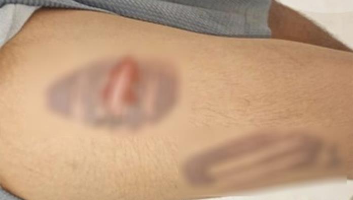 Investigan brutal agresión contra joven de Allende