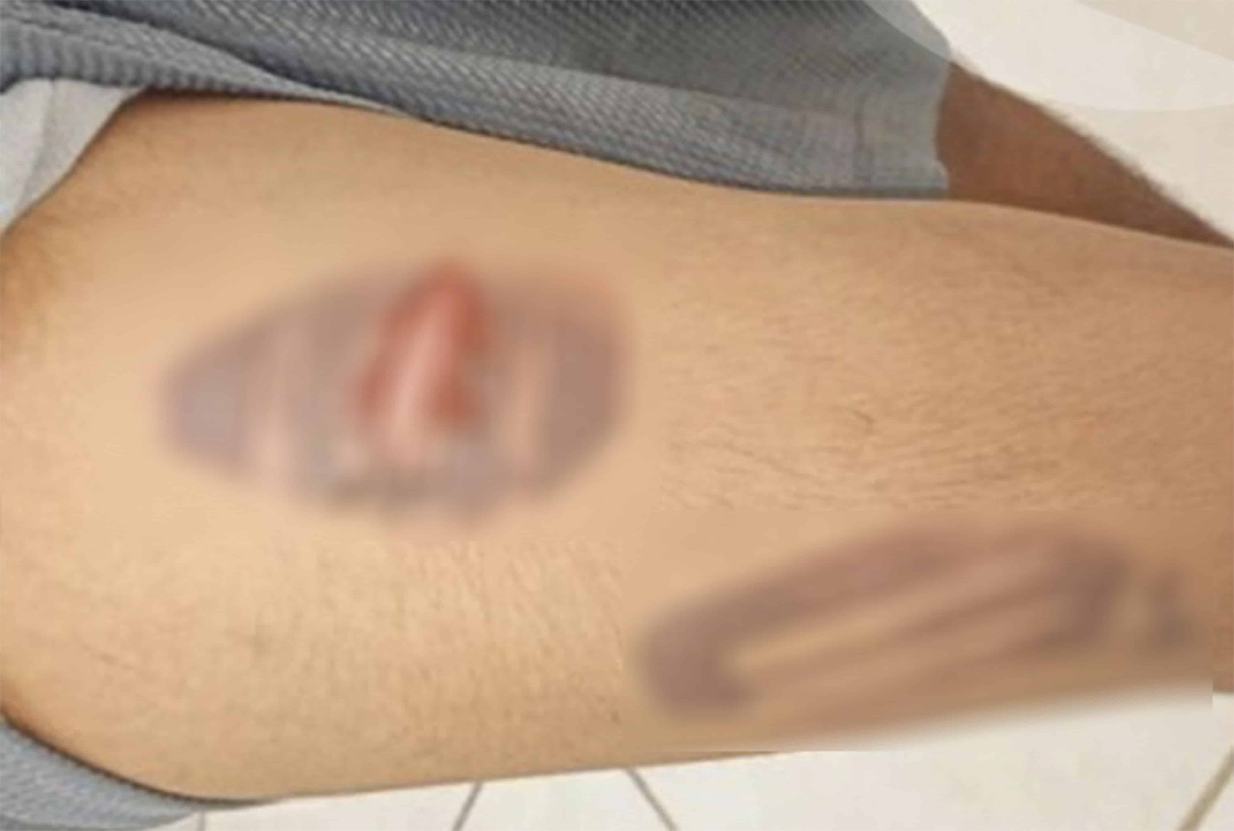 Investigan brutal agresión contra joven de Allende