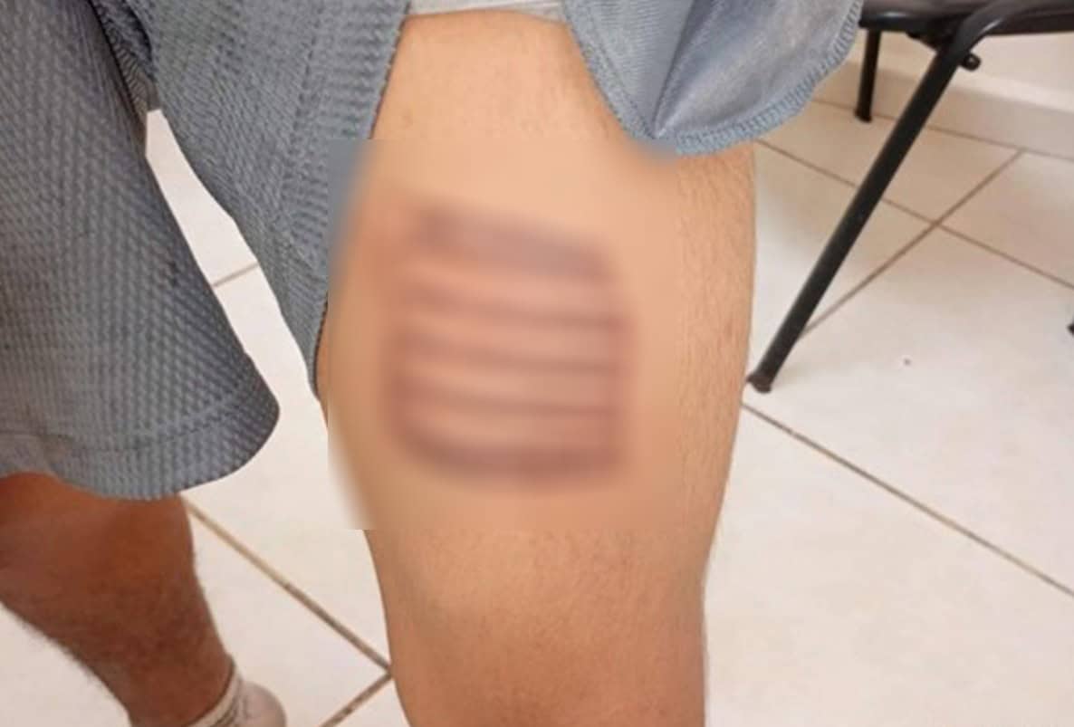 Investigan brutal agresión contra joven de Allende