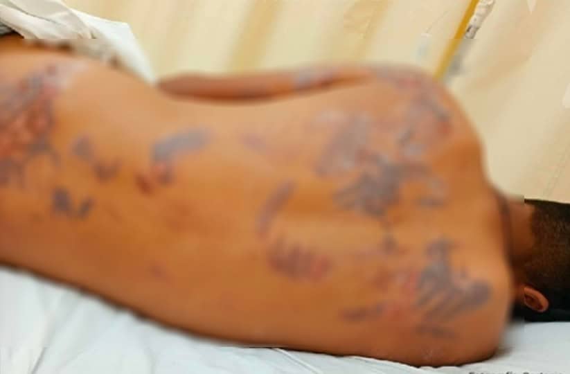 Investigan brutal agresión contra joven de Allende