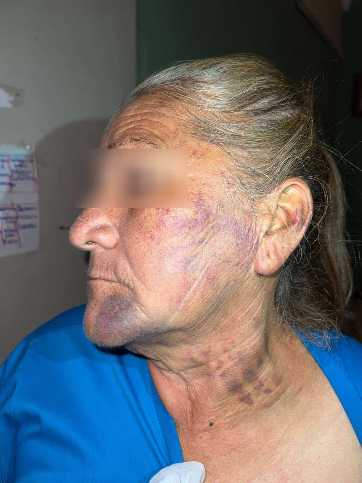 Cierran caso de violencia familiar porque "LAS HERIDAS NO FUERON DE GRAVEDAD"