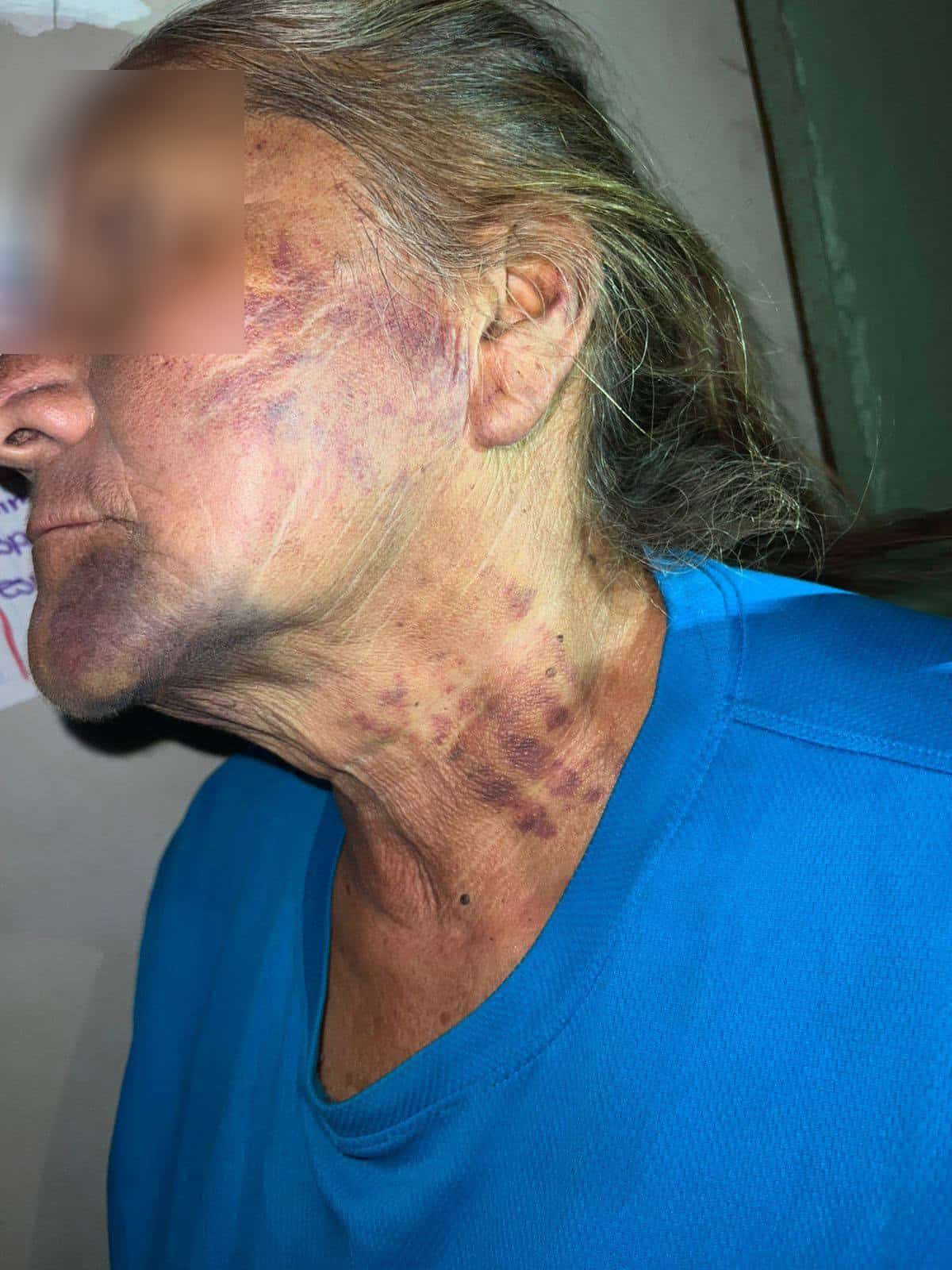 Cierran caso de violencia familiar porque "LAS HERIDAS NO FUERON DE GRAVEDAD"