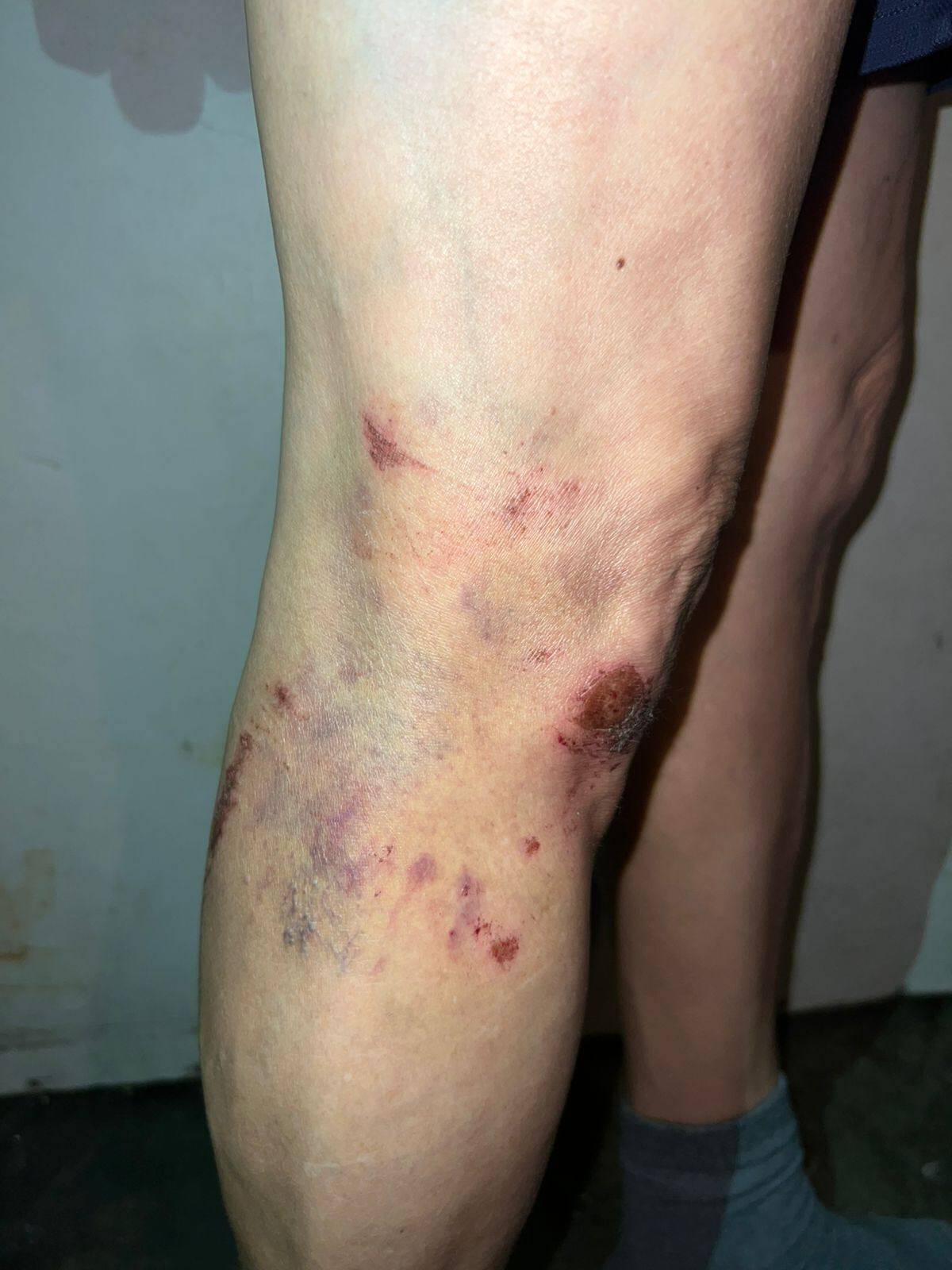 Cierran caso de violencia familiar porque "LAS HERIDAS NO FUERON DE GRAVEDAD"