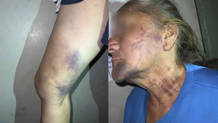 Cierran caso de violencia familiar porque “LAS HERIDAS NO FUERON DE GRAVEDAD”