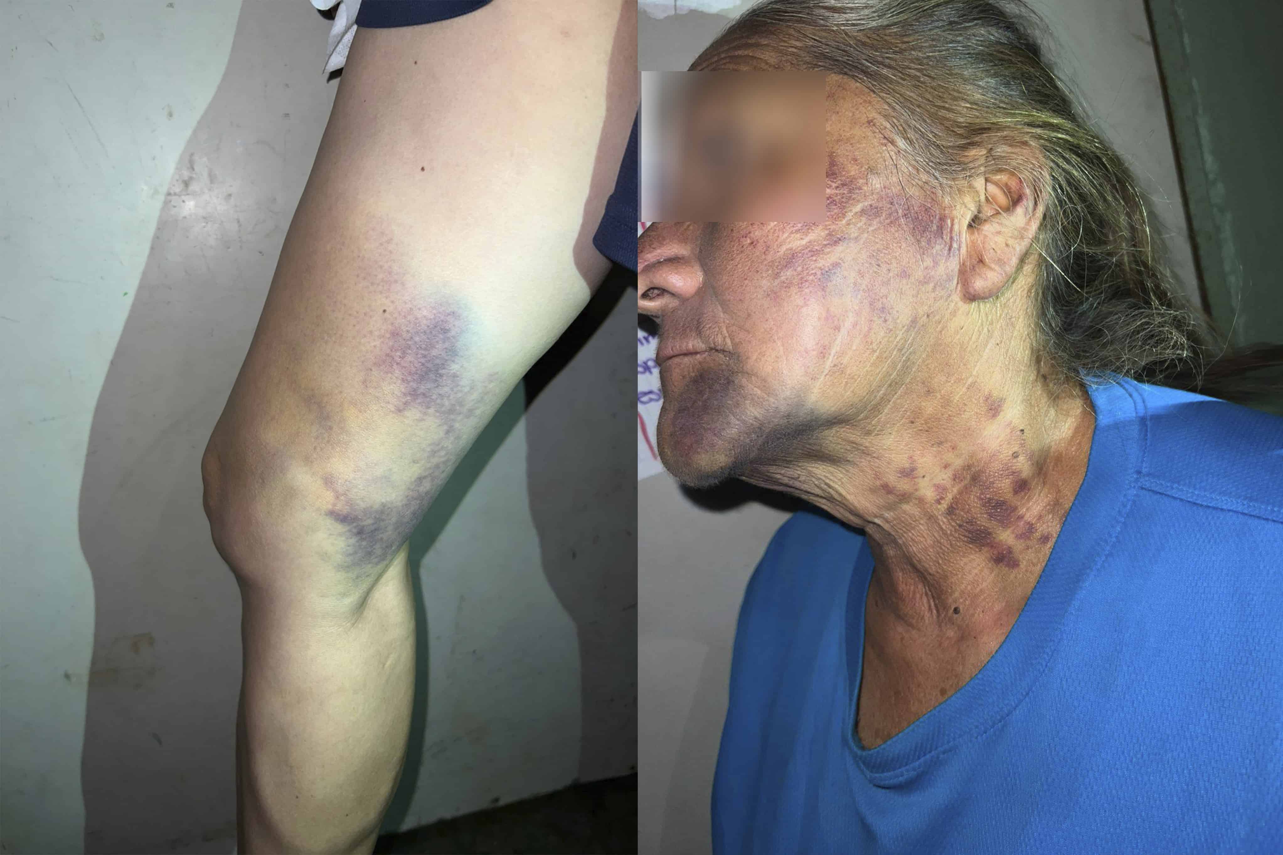 Cierran caso de violencia familiar porque "LAS HERIDAS NO FUERON DE GRAVEDAD"